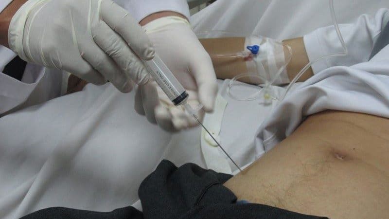 biến chứng chọc dịch ổ bụng