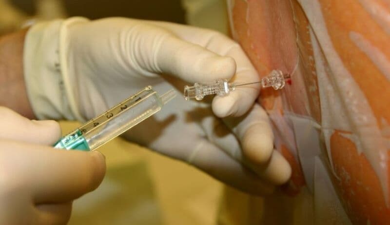 biến chứng chọc dịch ổ bụng