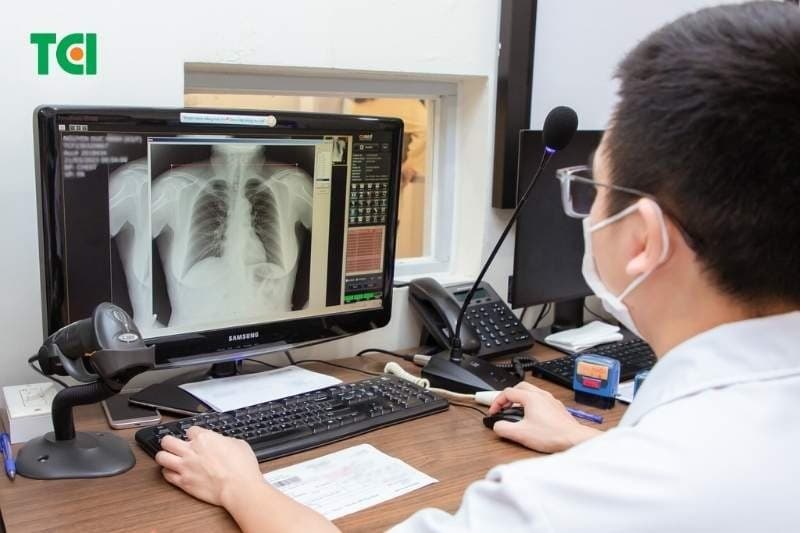 chụp x quang có phát hiện ung thư phổi không