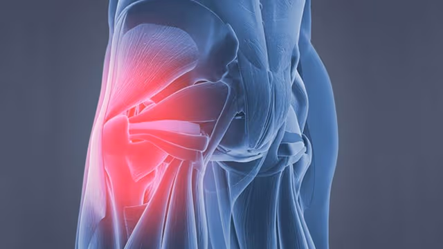 Cơ vòng hậu môn yếu: Vì sao và hậu quả?