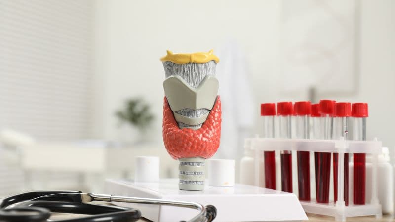 cường giáp dưới lâm sàng là gì