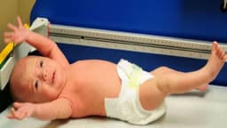 Dấu hiệu tăng trương lực cơ ở trẻ sơ sinh