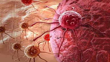 Điều trị tăng sinh mạch máu