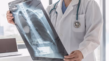 Chụp X quang có phát hiện ung thư phổi không?