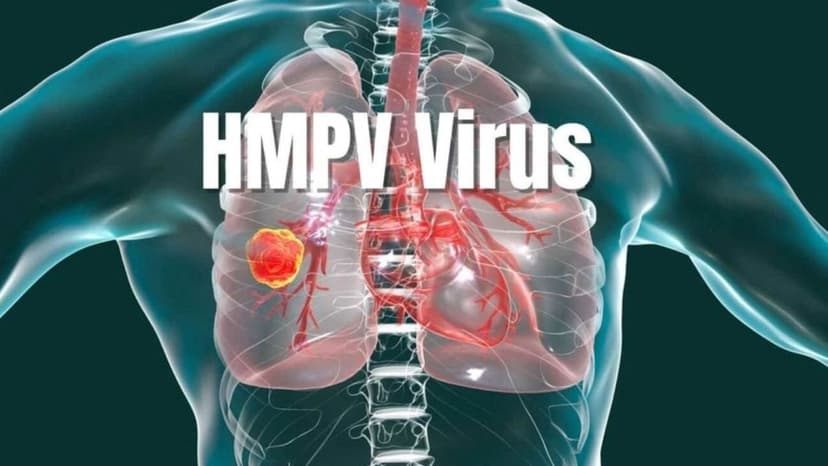 Virus gây bệnh viêm phổi ở người (hMPV) lây lan ở Trung Quốc và Việt Nam là gì?