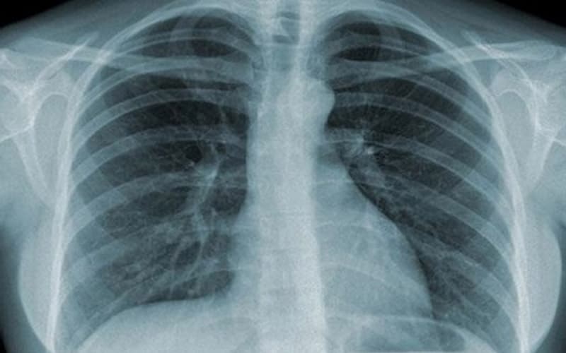 khám hô hấp là khám những gì