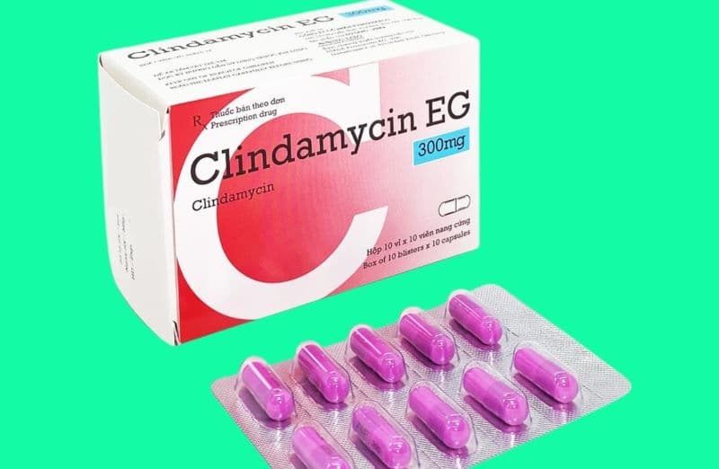 thuốc kháng sinh điều trị viêm tủy răng