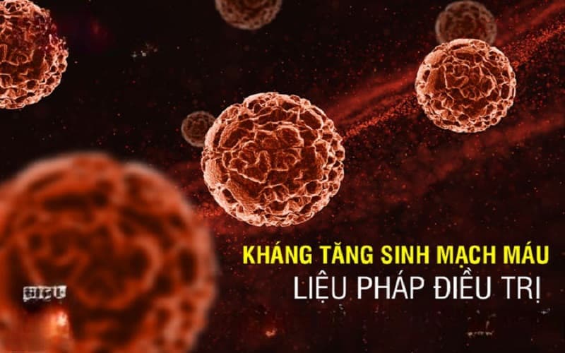 điều trị tăng sinh mạch máu