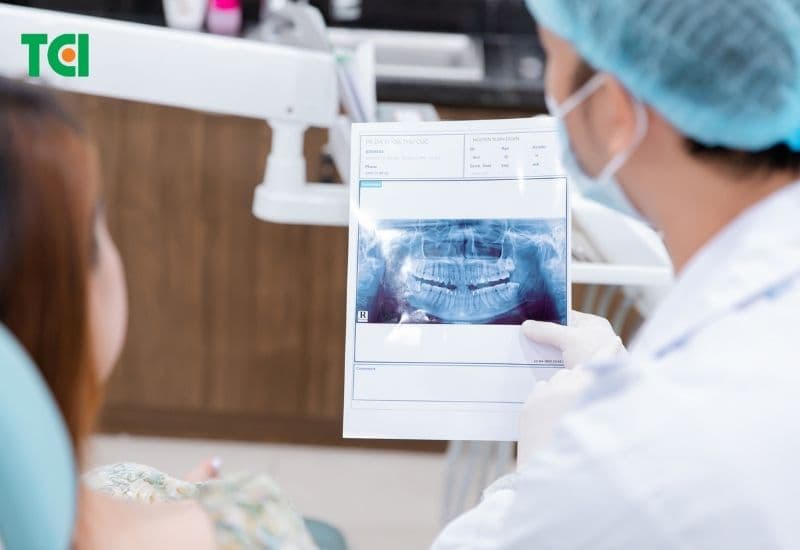 làm sao để biết răng khôn mọc thẳng hay lệch