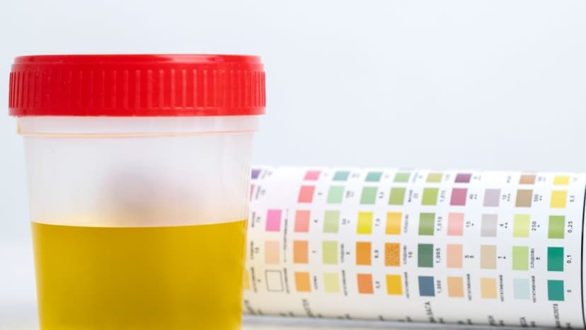 Mẹ bầu xét nghiệm nước tiểu để làm gì?