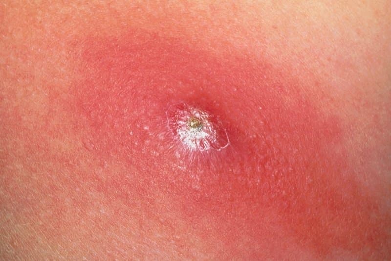 áp xe tái đi tái lại