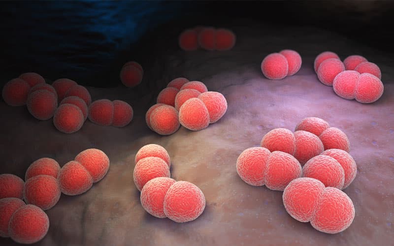 viêm màng não mô cầu ac và bc