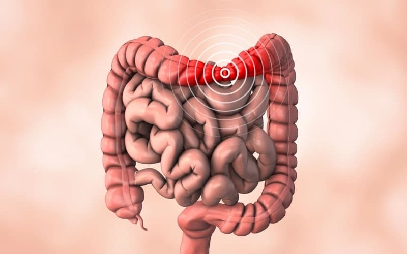 hội chứng ruột kích thích nên ăn gì