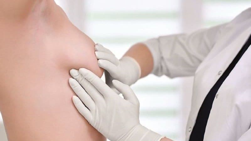 áp xe vú do sinh vật kỵ khí