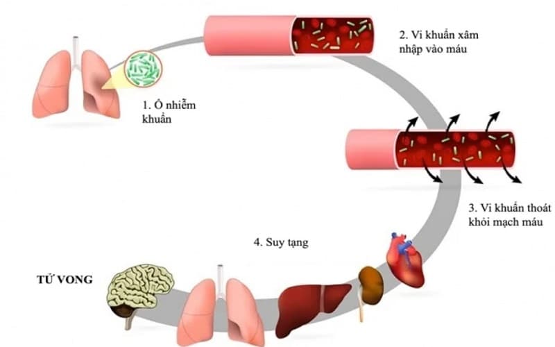 dấu hiệu của nhiễm trùng máu