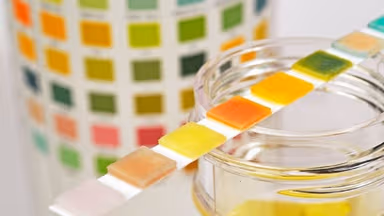 Những thay đổi trong nước tiểu: Nguyên nhân, triệu chứng và cách điều trị