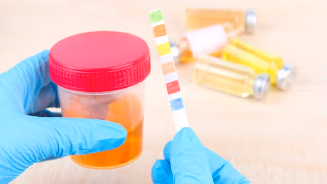 Giải đáp: Nước tiểu màu cam ở nữ là gì?