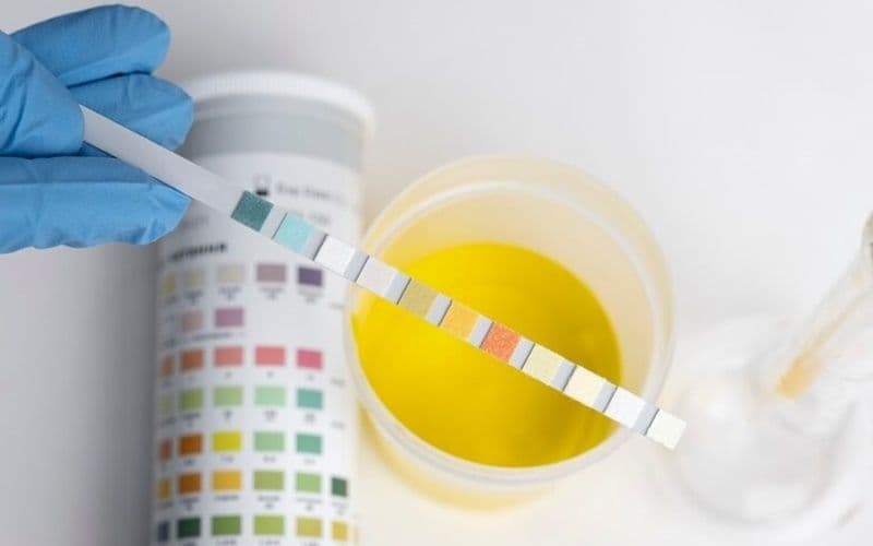 có thai nước tiểu màu gì