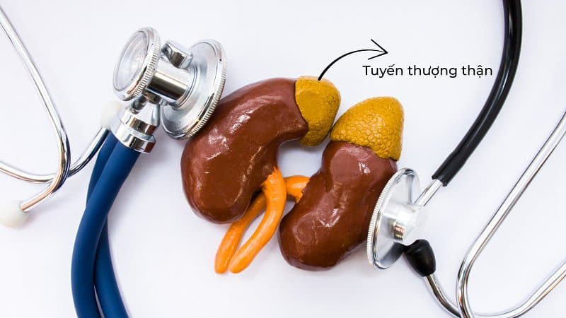 suy tuyến thượng thận do thuốc