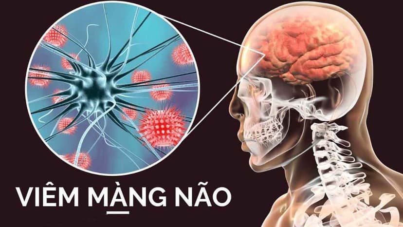 Phác đồ điều trị viêm màng não người lớn Bộ Y tế