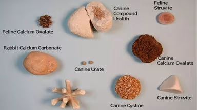 Sỏi tiết niệu có bao nhiêu loại và cách phân biệt chính xác nhất?