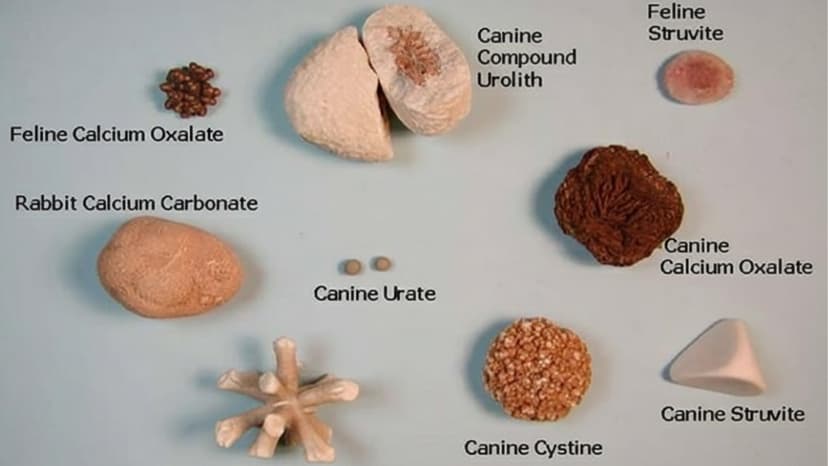 Sỏi tiết niệu có bao nhiêu loại và cách phân biệt chính xác nhất?