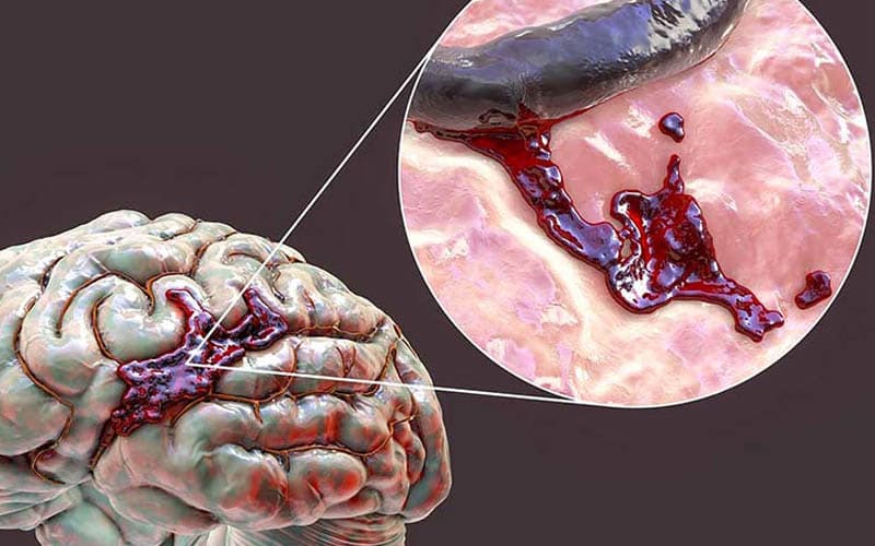 tác dụng phụ của thuốc chống đông máu