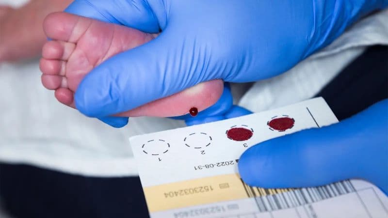 tăng sản thượng thận bẩm sinh