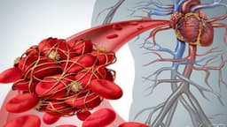 Điều trị chống đông máu trong bệnh tim mạch