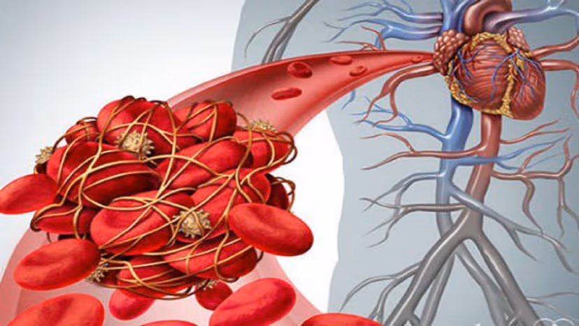 Điều trị chống đông máu trong bệnh tim mạch