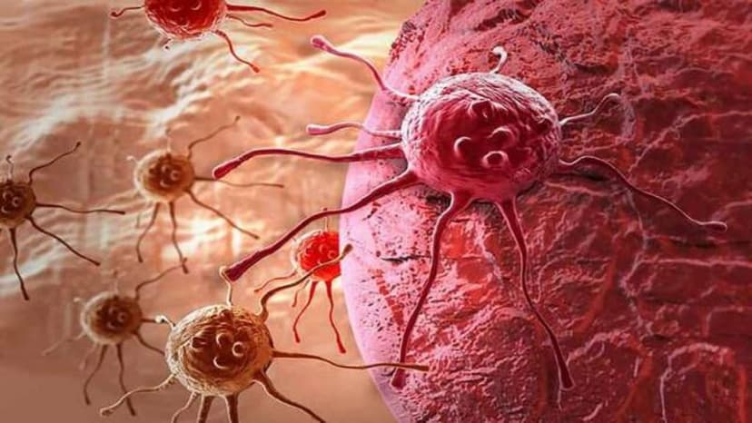 Vai trò của thuốc ức chế tăng sinh mạch máu trong điều trị ung thư