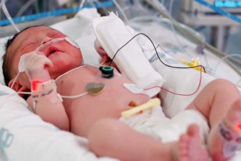 trẻ bị nhiễm trùng máu có nguy hiểm không