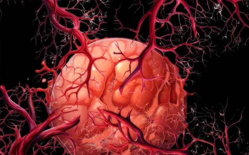 u lành tính có tăng sinh mạch máu không