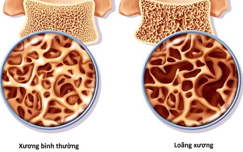 tác dụng phụ của thuốc chống đông máu