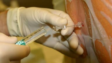 Vị trí chọc dịch ổ bụng để tháo dịch tràn dưới hướng dẫn siêu âm