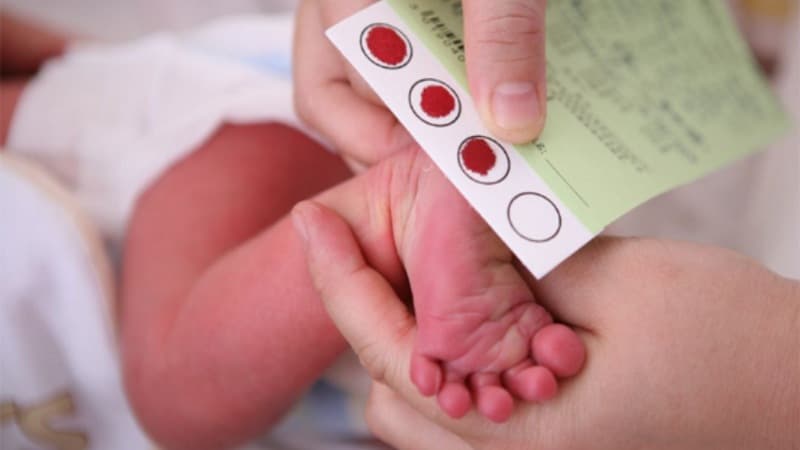 nguyên nhân trẻ bị suy giáp bẩm sinh