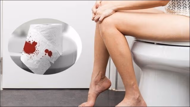 Xuất huyết hậu môn là bệnh gì?