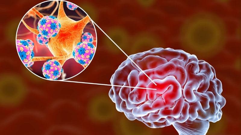 viêm màng não ở người lớn có chữa được không