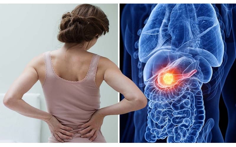 cách phát hiện ung thư tụy