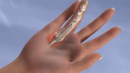 Đứt gân duỗi ngón tay bao lâu thì lành: Thời gian hồi phục và lưu ý