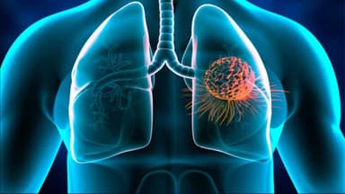 Các thuốc kháng sinh điều trị áp xe phổi