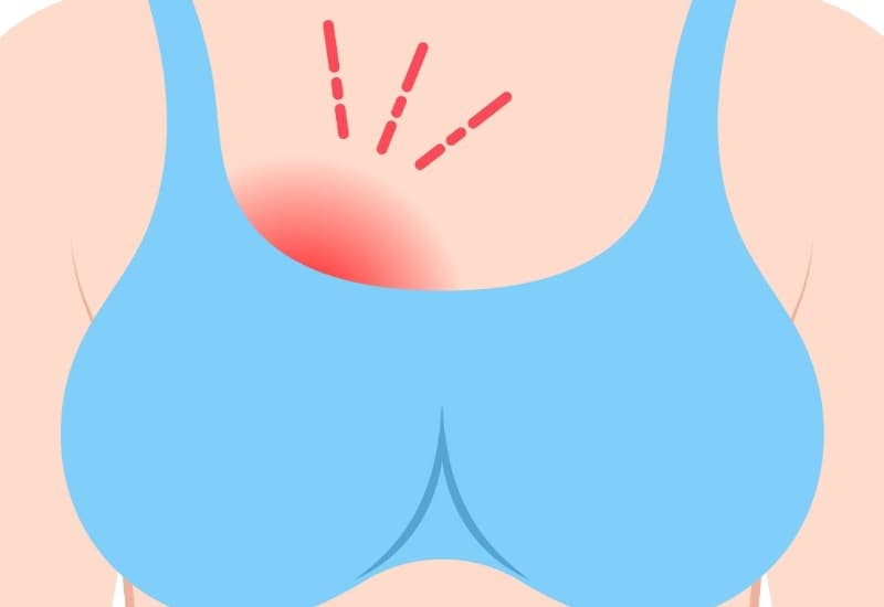 áp xe vú ở phụ nữ không cho con bú