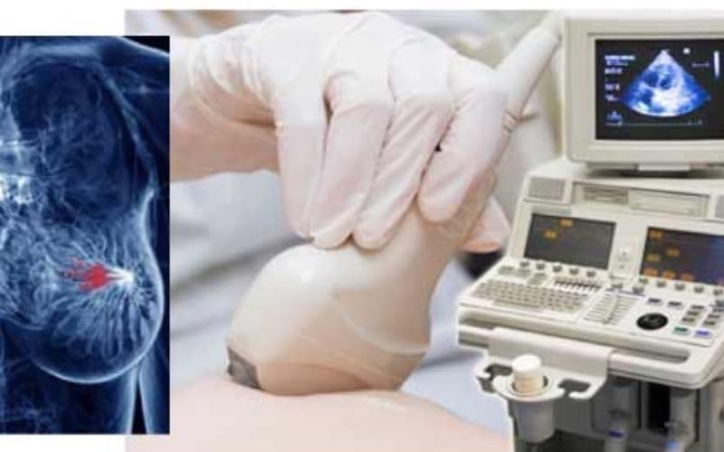 bầu có siêu âm vú được không