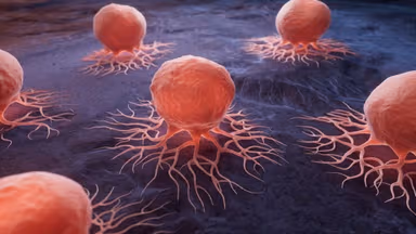 U lành tính là gì? Biểu hiện của khối u lành tính?