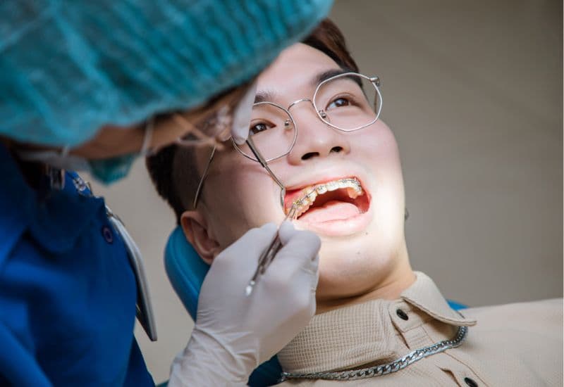 cách hết ê răng