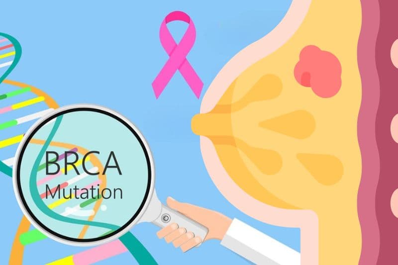 phòng ngừa ung thư vú