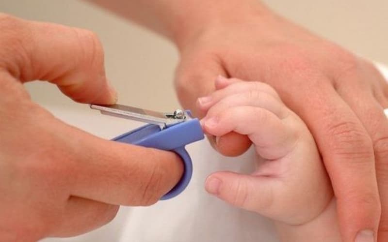 trẻ sơ sinh bị móng chọc thịt