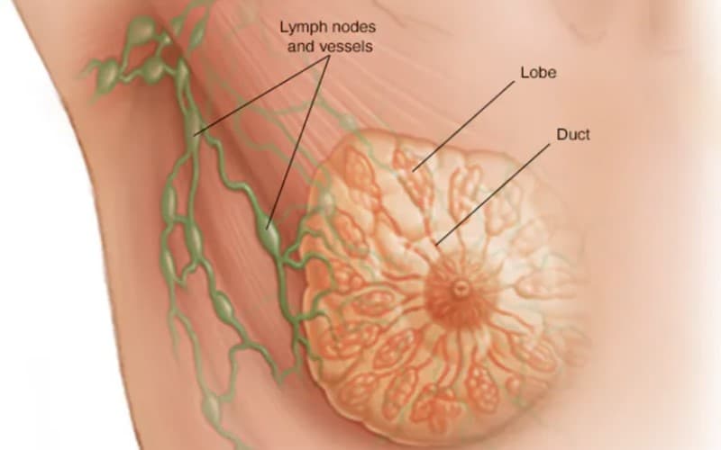 ung thư vú bộ ba âm tính là gì