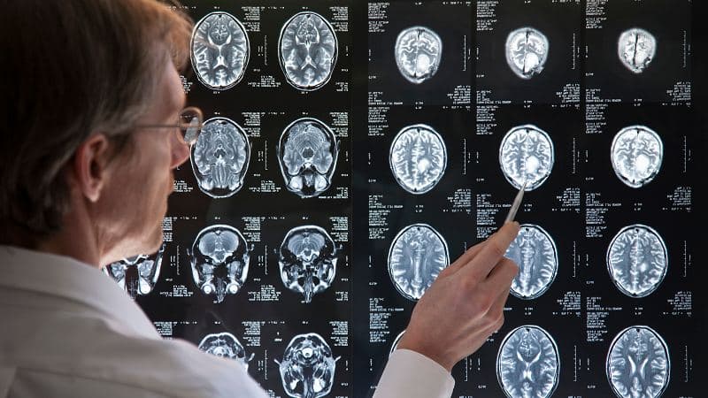 U não lành tính có chữa được không