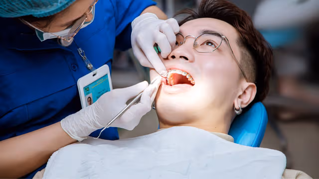 Niềng răng: Kéo cụm 4 răng cửa mất bao lâu?